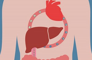 Addressing HDL Dysfunction through Functional Nutrition: Animation