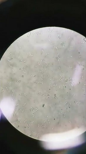 Yeast cell/ Yeast cell Budding || Yeast cells diagram