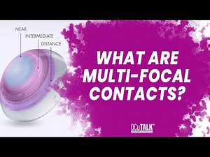 What are Multi-Focal Contacts? Dr. Corte explains