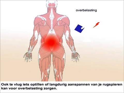Lage rugpijn - Oorzaken en behandeling
