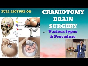 CRANIOTOMY-BRAIN SURGERY/ VARIOUS TYPES OF CRANIOTOMY & PROCEDURES/ HEAD INJURY SURGICAL MANAGEMENT