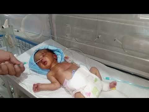 Pass NG Tube in NICU | ASD & VSD Newborn Baby Care |