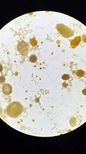 Stool sample microscopy🔬❣️ | Lab life