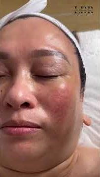 WhatsApp Video ✨ Age-defying luxury treatment ✨Experience the Ruby-Cell Intensive 4U Facial