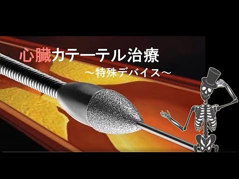 【心臓カテーテル治療】特殊デバイス！ロータブレーター、ダイアモンドバック、DCA、エキシマレーザー！