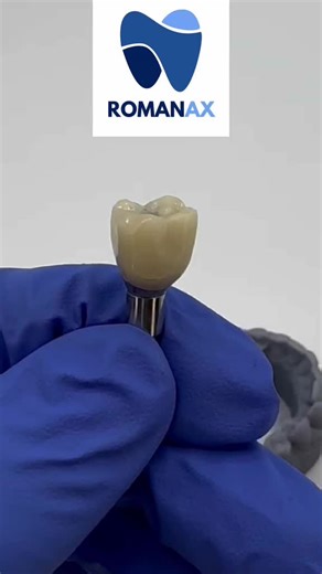 BioHorizons custom abutment and zirconia crown cemented “screwmentable” design #dental #3d #biohorizons