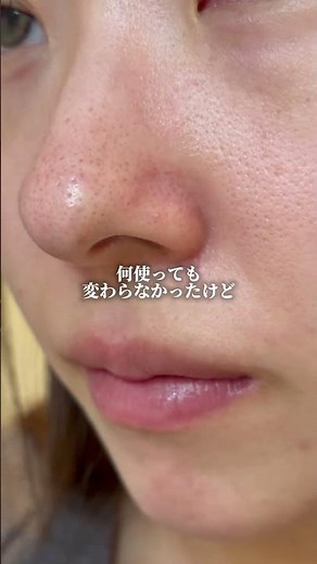 黒ずみ･毛穴開きが治るオイルクレンジング🫣洗い上がりはしっとりで、冬のメイク落としにぴったり❄️特割サイトはプロフに貼ってるよ！#クレンジング #黒ずみ #開き毛穴 #毛穴 pr