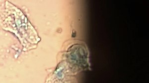 Cheek cells stained with methylene blue