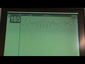 Telemetry Rhythms Explained
