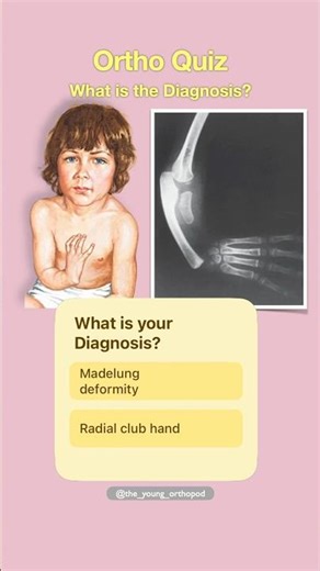 Can You Diagnose This Congenital Hand Deformity? 🖐️ | Orthopaedics Quiz #shorts