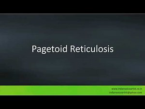 Pronunciation of the word(s) "Pagetoid Reticulosis".