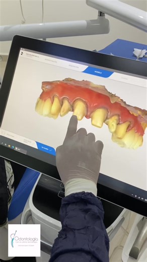 Innovaciones en Tecnología 3D para Odontología