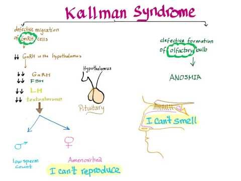 Kallmann Syndrome