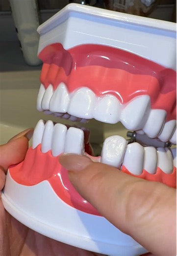 DIY Fake Tooth in One Minute: Quick Guide