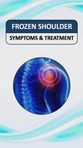 What Is Frozen Shoulder? Don’t Ignore Shoulder Pain! Struggling with shoulder stiffness, pain, or limited movement? You might be facing Frozen Shoulder (Adhesive Capsulitis) — a condition that affects your daily activities and worsens without proper care. 🔍 Key Symptoms: ✔ Persistent shoulder pain ✔ Stiffness & restricted movement ✔ Difficulty lifting the arm ✔ Pain worsening at night 💡 Treatment Options: • Pain & anti-inflammatory medicines • Physiotherapy & mobility exercises • Steroid injec