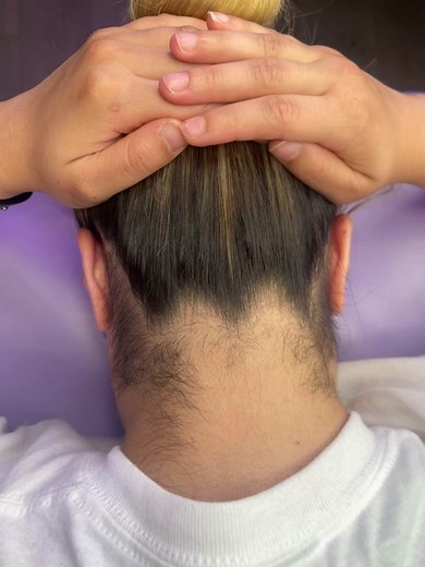Hairline Waxing for Neck Hair Removal