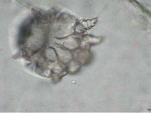 Scabies Mite Live