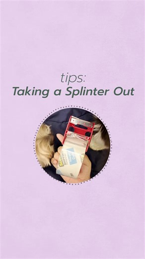 Simple Tips for Removing Splinters Easily