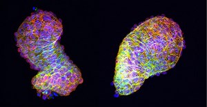 What the Zebrafish Heart Says About Congenital Heart Defects | Cardiology