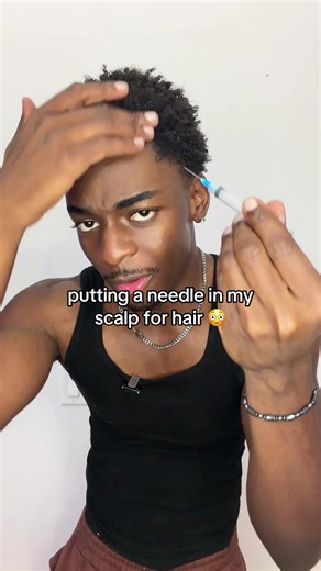 Transform Your Hairline with Innovative Hair Serum