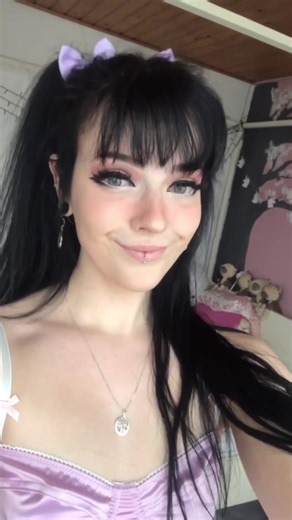 Idk wat die bloeduitstorting in m’n oog is