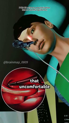 Sinusitis And Balloon Sinuplasty 3D Animation