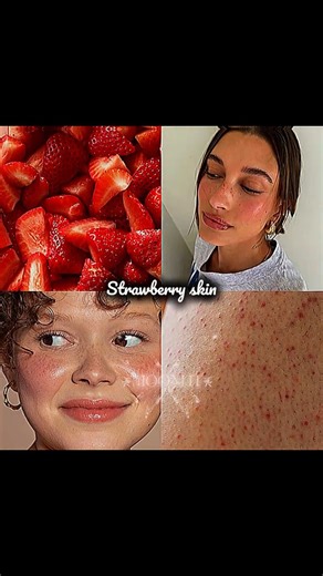 ALL SKINS ARE BEAUTIFUL💗☁️🌷#aesthetic#fypシ゚viral#tiktokvideo#trend#viral#trending#skincare#shorts