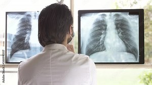 Confused doctor checking chest x-ray films of complex respiratory medical condition for accurate diagnosis