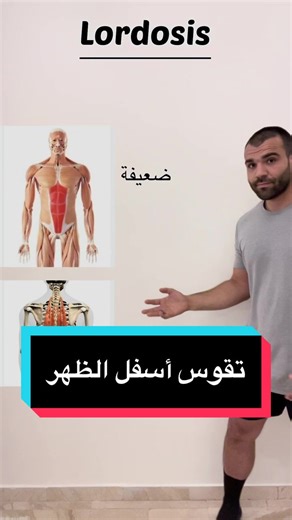 Effective Exercises for Correcting Lumbar Lordosis