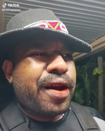 Roll On 🤘🏾😂 #fyp #kabbagegangentertainment #kabbage #kabbagegang #pngcomedy #papuanewguinea