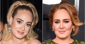 Did Adele Get a Nose Job? Expert Weighs in After Weight Loss