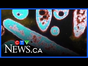 Everything you need to know about Legionnaires’ disease
