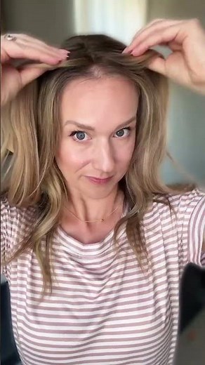 Hair Topper Placement: Front, Back, or Hairline? See What Looks Best! | UniWigs Upgrade Courtney