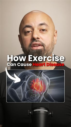 Did you know that exercise could actually cause heart disease? It sounds insane, right? But here's exactly what happened to a world-class tennis player that I personally worked with. This guy was elite, Wimbledon level. He ate everything right, did everything right, trained all day, but still, his doctor found that he had high cholesterol. So we ran his DNA and what we found blew us away. He had really bad mitochondrial genetics. This means his body wasn't good at clearing something. Call an oxi