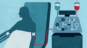 How CAR-T therapy works in autoimmune diseases