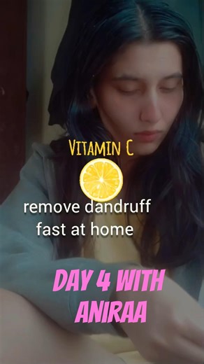 remove dandruff fast at home | home treatment #explore #fashionstyle