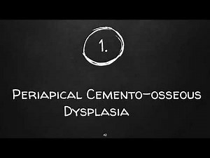 MNEMONIC: Periapical Cemento-Osseous Dysplasia |Oral Pathology Mnemonics - Rememberology
