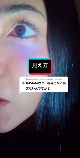 ぶどう膜炎症状と見え方に関する体験談｜隠れミッキーや白内障の影響も
