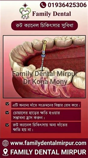 Teeth Treatment. dater cikitsha. দাঁতের চিকিৎসা। Dr Kona Mony. Family Dental Mirpur Dentist