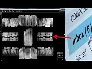 CS Imaging - Mounting JPEG XRAYS