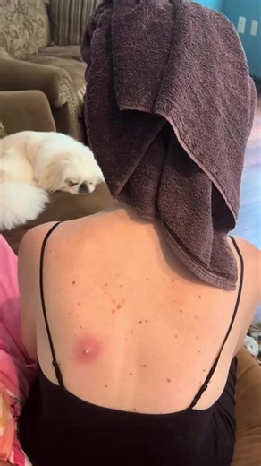 Let's Clean Up 2025 💕💕 (9) | Pimple Popper