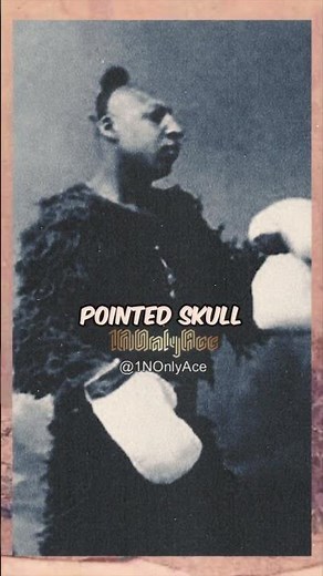 Scary Exploitation: The Sad Story of Zip the Pinhead #shorts