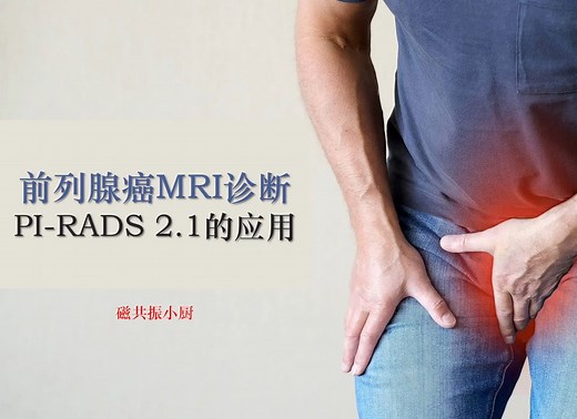 前列腺癌MRI诊断及 PI-RADS 2.1的解读（一）
