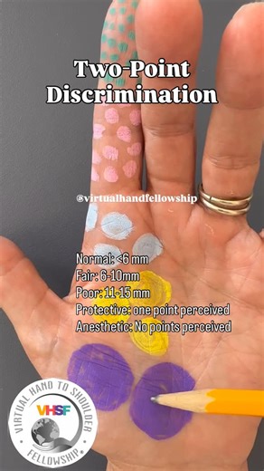 Virtual Hand to Shoulder Fellowship on Instagram: "Two-point discrimination is one tool for evaluating tactile spatial resolution, especially following nerve injury or repair, but it should always be interpreted alongside other assessments. Combine it with monofilament testing, localization, and functional task evaluation to form a more complete understanding of sensory function. 📚 This topic reflects the kind of advanced, evidence-based critical reasoning cultivated in the Virtual Hand to Shou