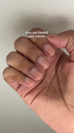 Dark Cuticles Treatment: How to Heal and Transform Your Nails