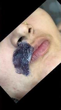 Upper lips waxing tutorial for sensitive skin #upperlipswax #brazillianwax #peeloffwax #hardwaxbeans