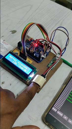 Non-Invasive Glucometer with Bluetooth monitoring using Arduino UNO