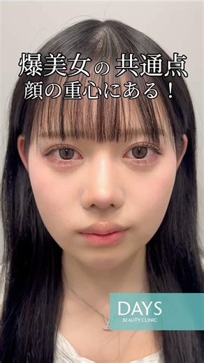 [Full face plastic surgery] Do you know what beautiful women have in common? #shorts