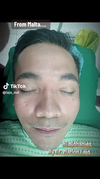 Day 1 of My Rhinoplasty Journey with Dr. Lajo