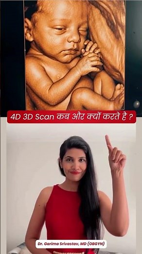 3D 3-dimensional image of the baby’s surface.3D scan in motion is 4D #pregnancyultrasound #pregnant